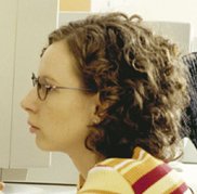Myopia