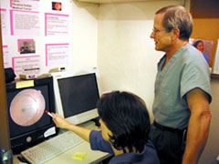 Macular Degeneration & Cataract Surgery