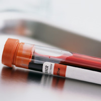 blood test for c-reactive protein inflammation macular degeneration
