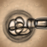 stem cells for macular degeneration
