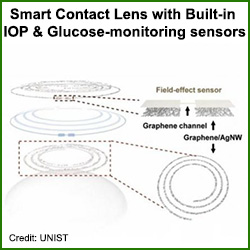 glaucoma diabetes smart contact lenses