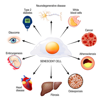 senescent cell diseases