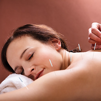 acupuncture treatment