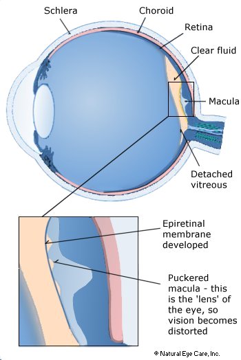 eye-x-section-back-of-eye